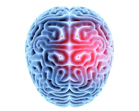 Brain with concussion areas highlighted. 