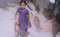 Child with crutches. 