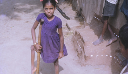 Child with crutches. 