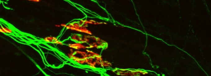 cells. 