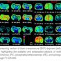 Images of brain scans highlighting levels of sodium and potasium. 