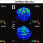 Six brain scan intensity maps show concentrations of a naturally occurring neurotransmitter. 
